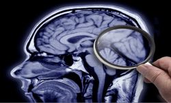 اكتشاف رائد قد يحمل مفتاح علاج ألزهايمر قبل عقود من ظهور الأعراض